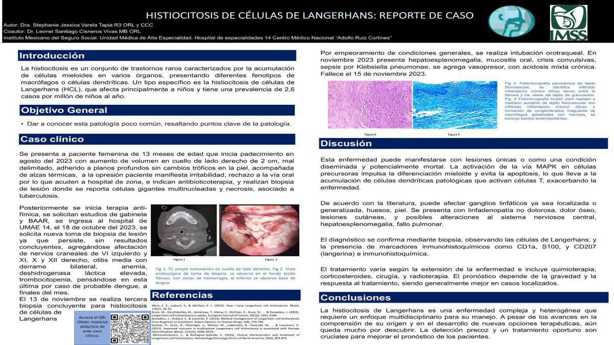 CNUM 9 - HISTIOCITOSIS DE CÉLULAS DE LANGERHANS: REPORTE DE CASO