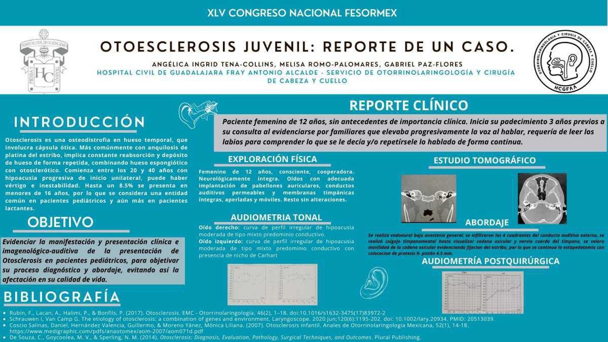 CNUM 13 - OTOESCLEROSIS JUVENIL: REPORTE DE UN CASO