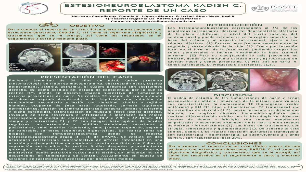 CNUM 19 - ESTESIONEUROBLASTOMA KADISH C. REPORTE DE UN CASO