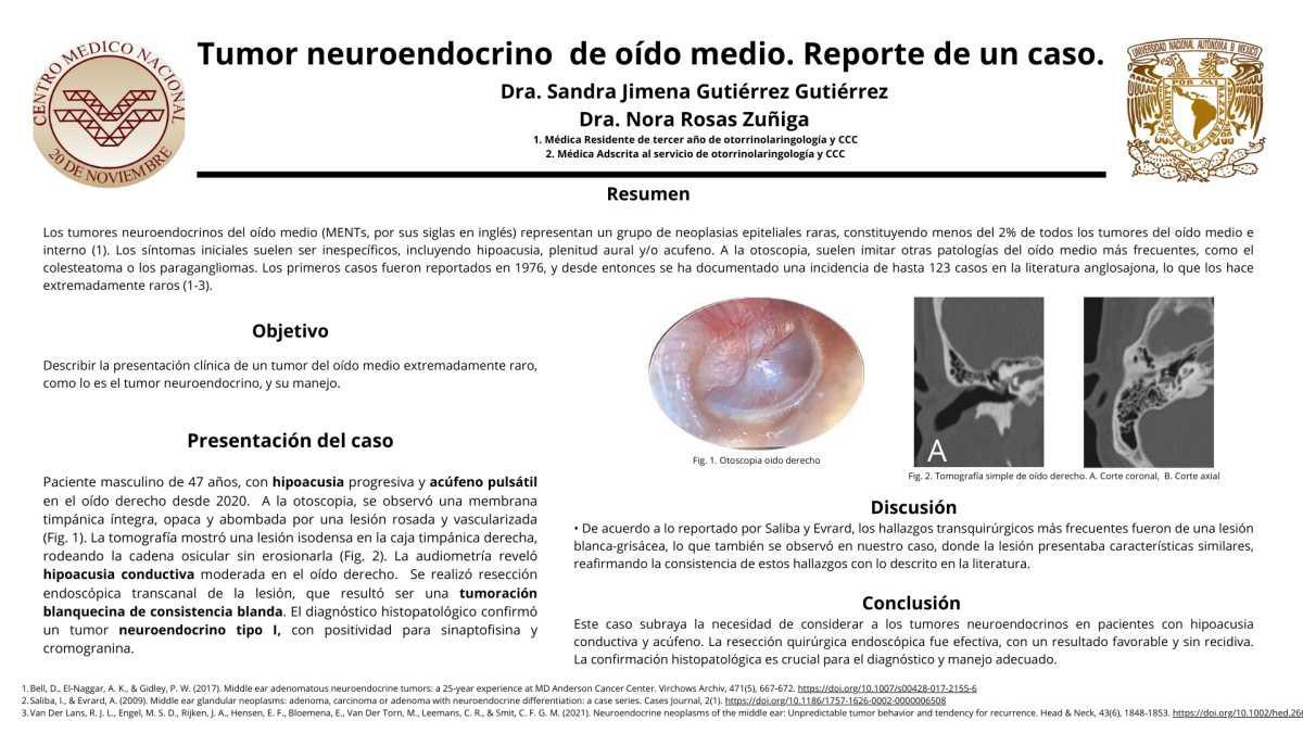 CNUM 23 - TUMOR NEUROENDOCRINO DEL OÍDO MEDIO. REPORTE DE UN CASO.