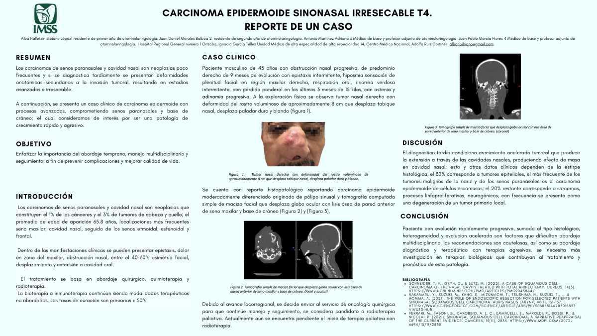 CNUM 29 - CARCINOMA EPIDERMOIDE SINONASAL IRRESECABLE T4. REPORTE DE UN CASO