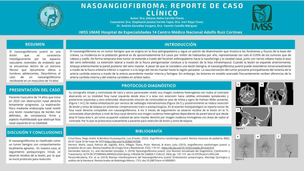 CNUM 30 - NASOANGIOFIBROMA: REPORTE DE UN CASO CLÍNICO