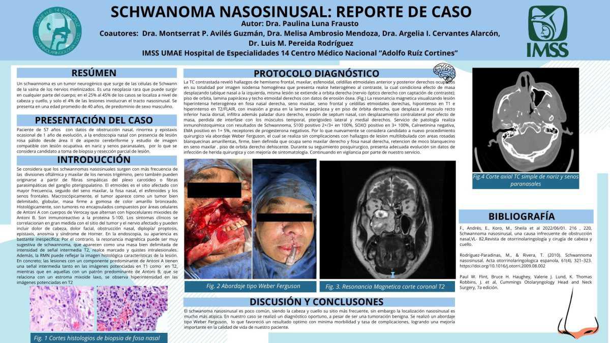 CNUM 31 - SCHWANOMA NASOSINUSAL: REPORTE DE CASO