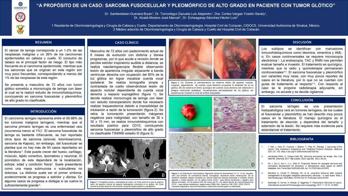  CNUM 32 - A PROPÓSITO DE UN CASO: SARCOMA FUSOCELULAR Y PLEOMÓRFICO DE ALTO GRADO NO CLASIFICABLE EN PACIENTE CON TUMOR GLÓTICO