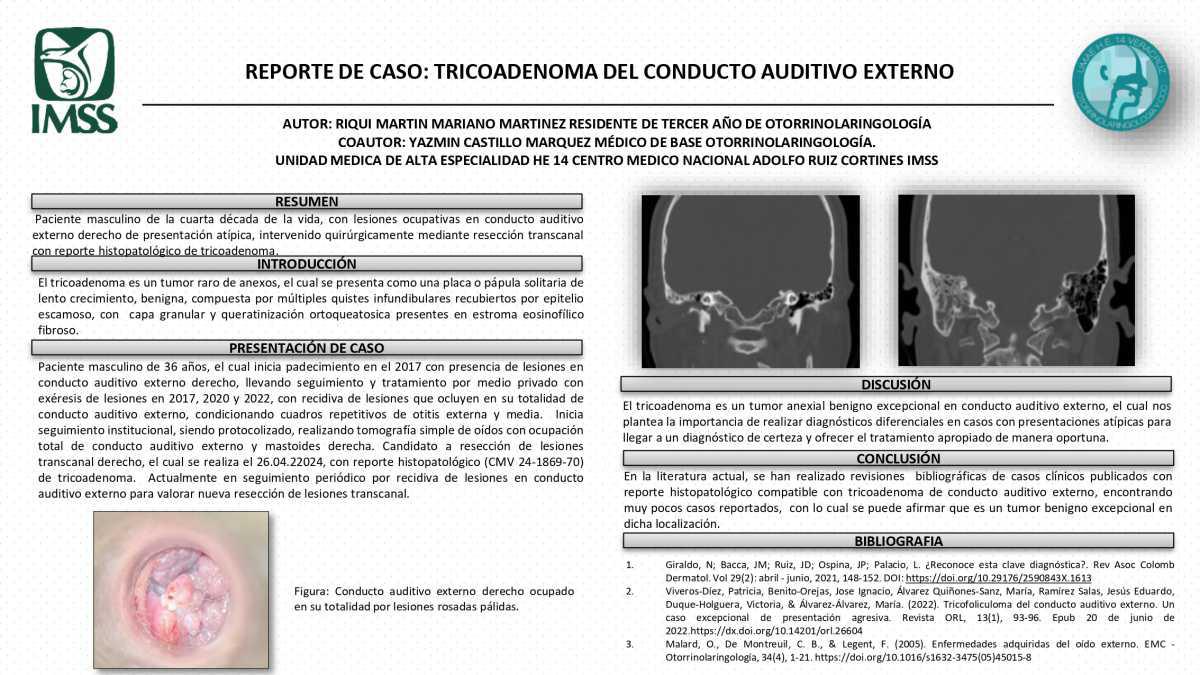 CNUM 34 - REPORTE DE CASO: TRICOADENOMA DEL CONDUCTO AUDITIVO EXTERNO