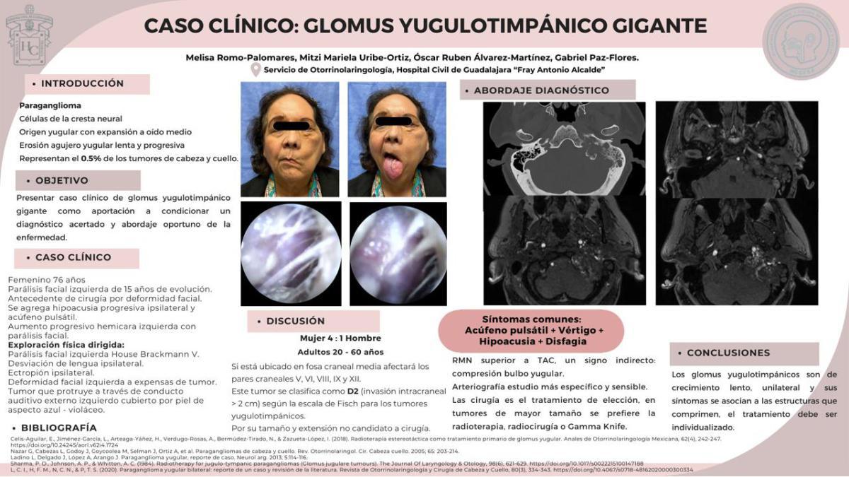 CNUM 37 - CASO CLÍNICO: GLOMUS YUGULOTIMPÁNICO GIGANTE