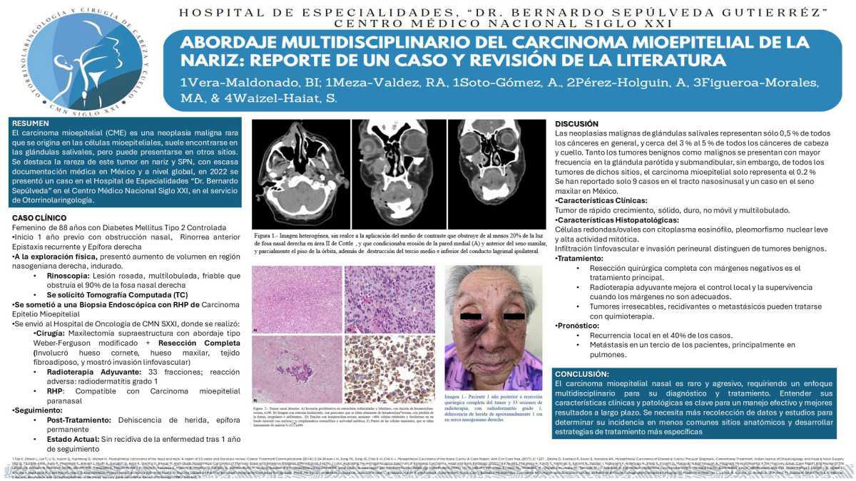 CNUM 39 - ABORDAJE MULTIDISCIPLINARIO DEL CARCINOMA MIOEPITELIAL EN NARIZ: REPORTE DE UN CASO Y REVISIÓN DE LA LITERATURA