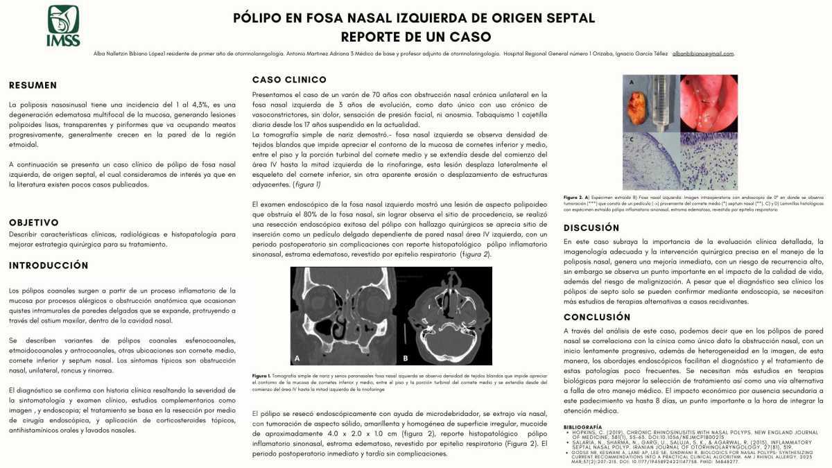 CNUM 40 - PÓLIPO EN FOSA NASAL IZQUIERDA DE ORIGEN SEPTAL REPORTE DE UN CASO