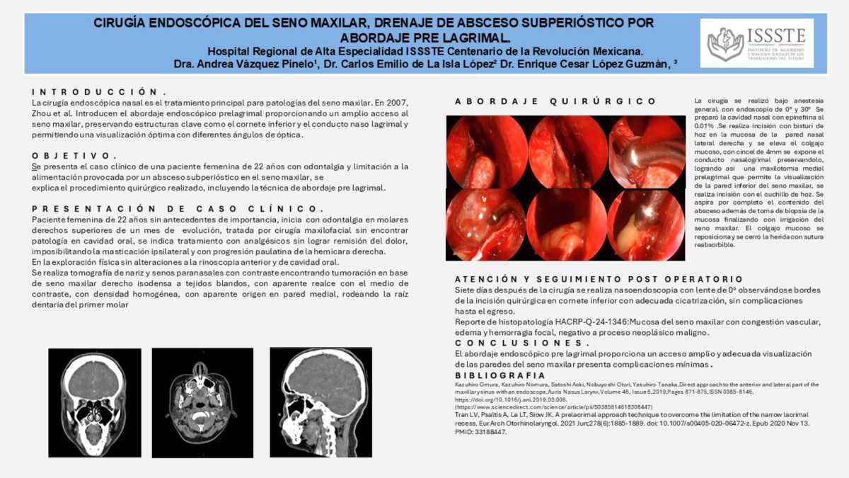 CNUM 42 - CIRUGÍA ENDOSCÓPICA DEL SENO MAXILAR, DRENAJE DE ABSCESO SUBPERIÓSTICO POR ABORDAJE PRE LAGRIMAL.