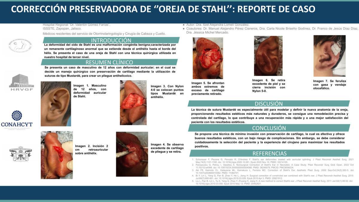 CNUM 46 - CORRECCIÓN PRESERVADORA DE ‘’OREJA DE STAHL’’: REPORTE DE CASO