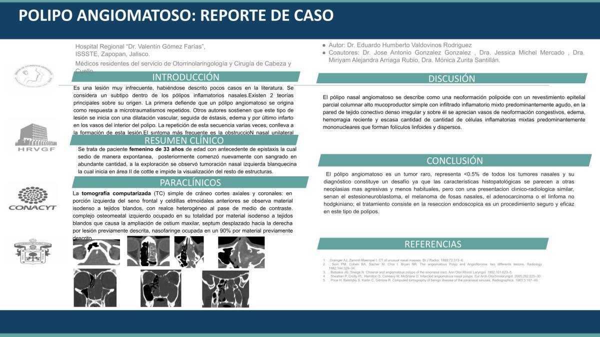 CNUM 48 - PÓLIPO ANGIOMATOSO: REPORTE DE CASO