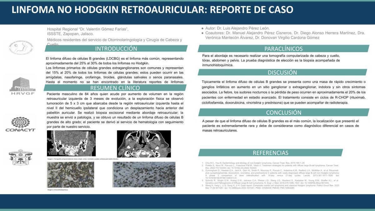 CNUM 49 - LINFOMA NO HODGKIN RETROAURICULAR: REPORTE DE CASO