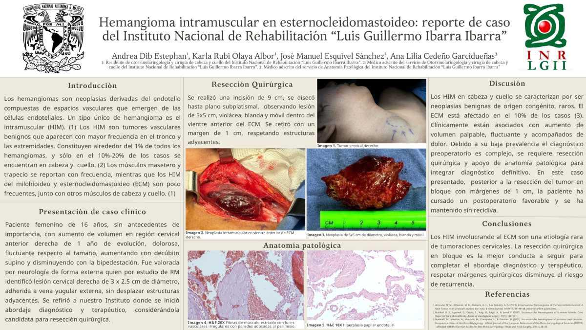 CNUM 51 - HEMANGIOMA INTRAMUSCULAR EN ESTERNOCLEIDOMASTOIDEO: REPORTE DE CASO DEL INSTITUTO NACIONAL DE REHABILITACIÓN “LUIS GUILLERMO IBARRA IBARRA”