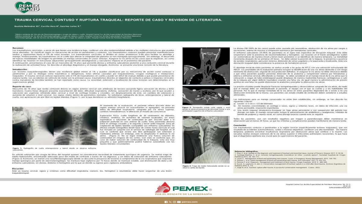 CNUM 52 - TRAUMA CERVICAL CONTUSO Y RUPTURA TRAQUEAL: PRESENTACIÓN DE UN CASO