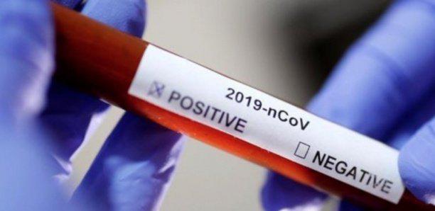 Covid-19 : 7 cas positifs enregistrés à Vélingara