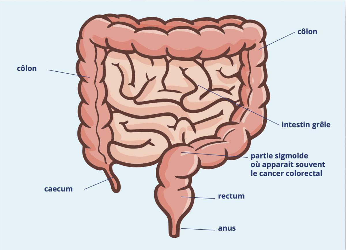 Qu'est-ce que c'est le cancer colorectal ? Qu'est-ce que c'est le cancer colorectal ?