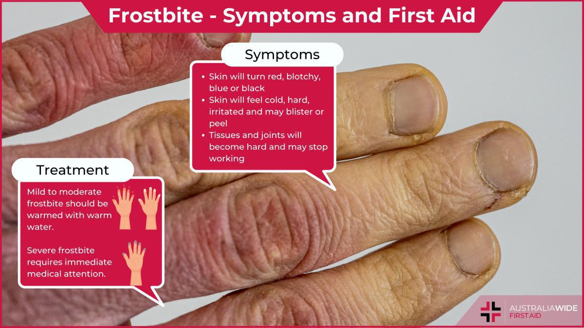 Winter Storms in January 2025... still coming... Winter Storms in January 2025... still coming...