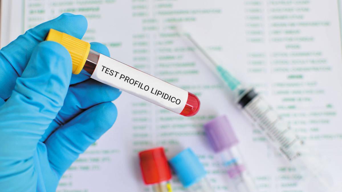 PROFILO LIPIDICO PROFILO LIPIDICO