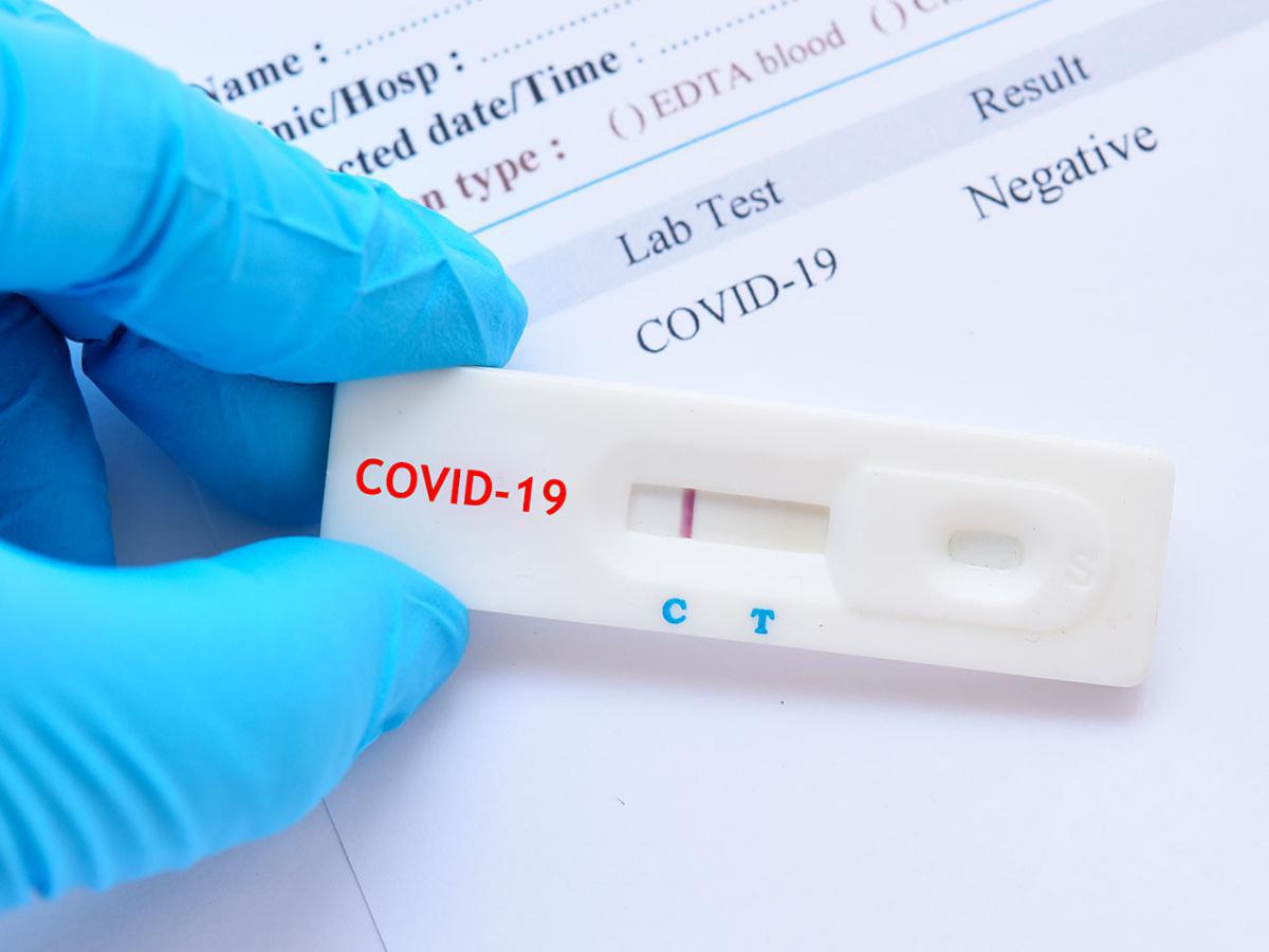 TAMPONE RAPIDO TAMPONE RAPIDO