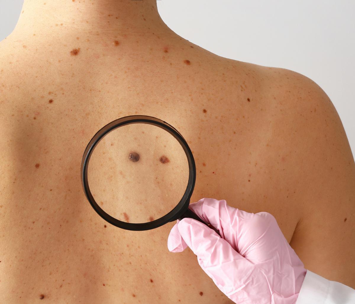 Teledermatologia Teledermatologia