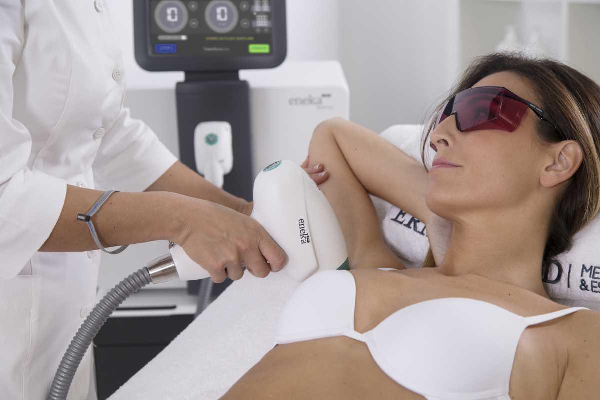 Laser Hair Removal