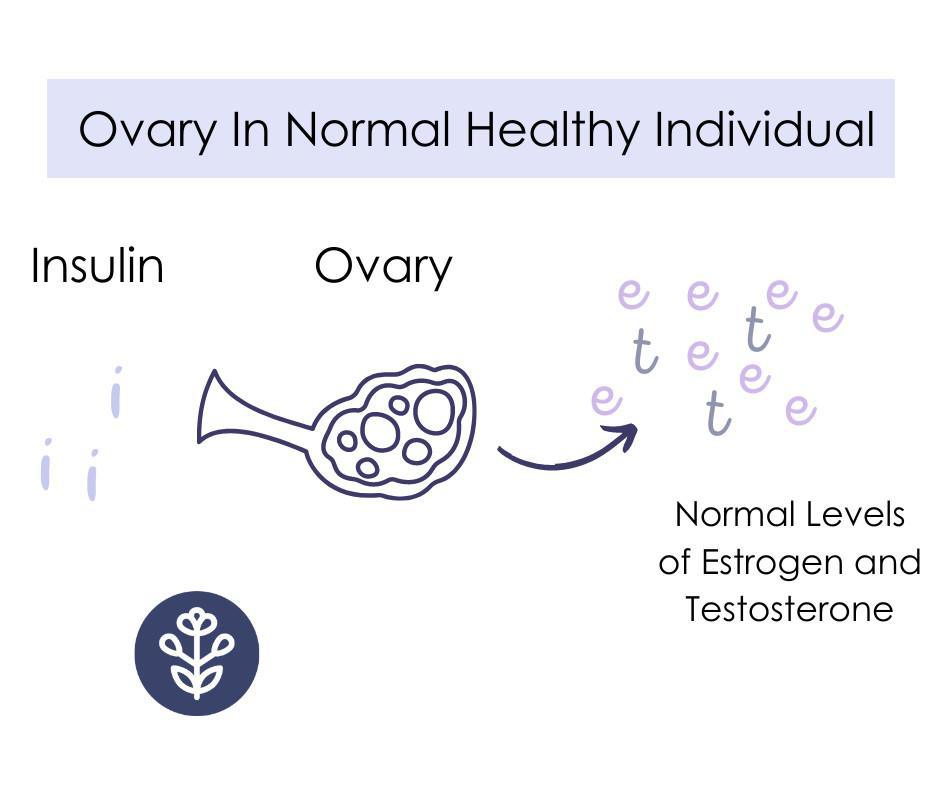 Inositol Supplements for PCOS