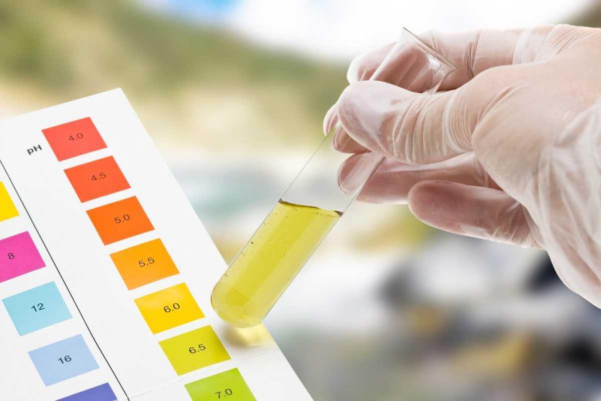 ANALISI DELLE URINE ANALISI DELLE URINE
