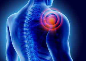Degenerative Joint Disease/Osteoarthritis