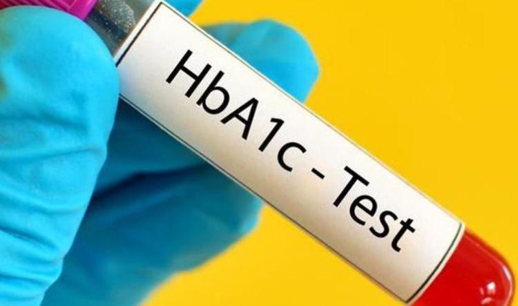 L'hémoglobine glyquée : qu'est-ce que c'est ?