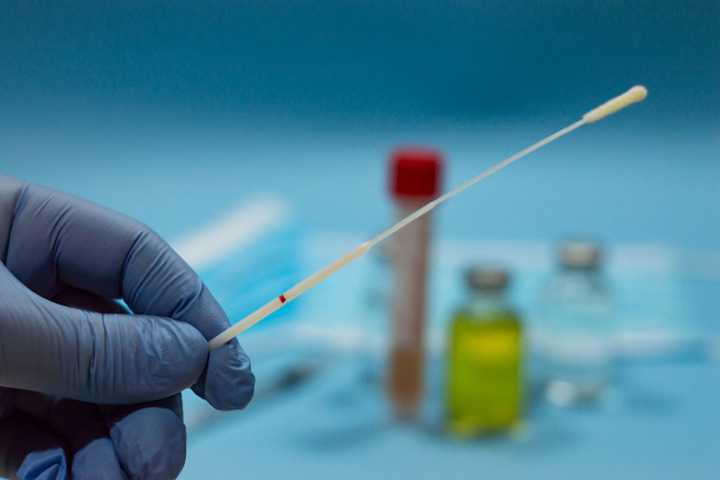 Tampone rapido Tampone rapido