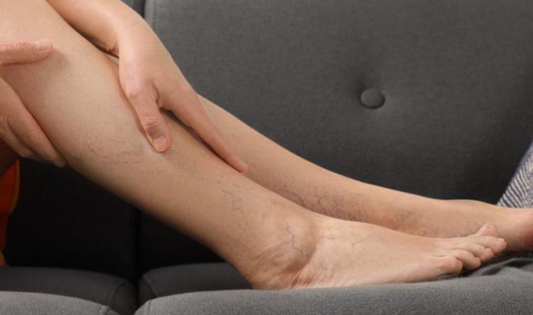 Ätherische Öle für die Gefäßgesundheit