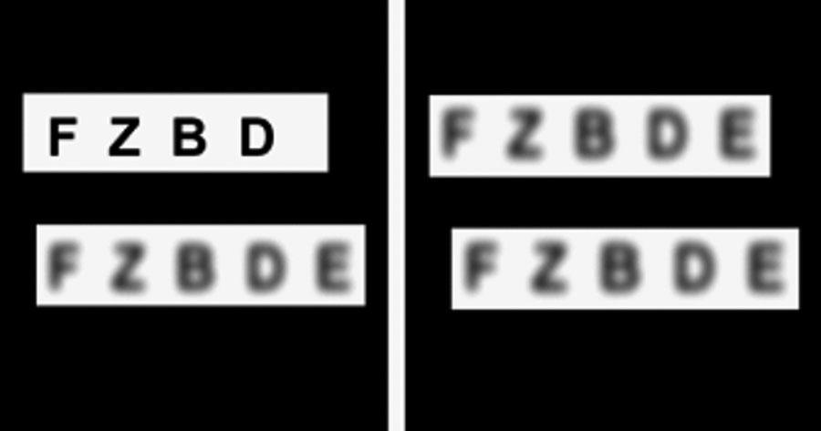 Balance y ecualización de la refracción (SUBJETIVO BINOCULAR DE LEJOS) Balance y ecualización de la refracción (SUBJETIVO BINOCULAR DE LEJOS)