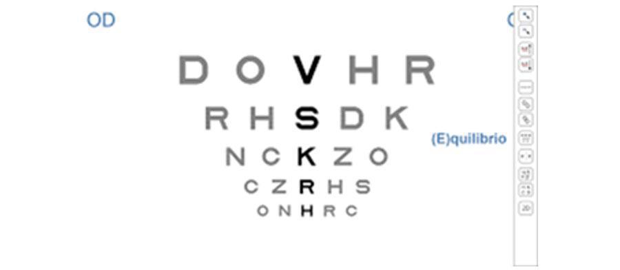 Balance y ecualización de la refracción (SUBJETIVO BINOCULAR DE LEJOS) Balance y ecualización de la refracción (SUBJETIVO BINOCULAR DE LEJOS)