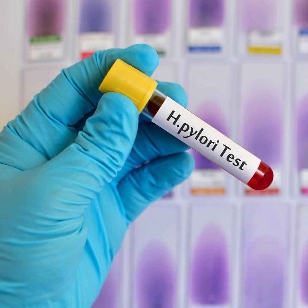 Breath Test per Helicobacter Pylori Breath Test per Helicobacter Pylori