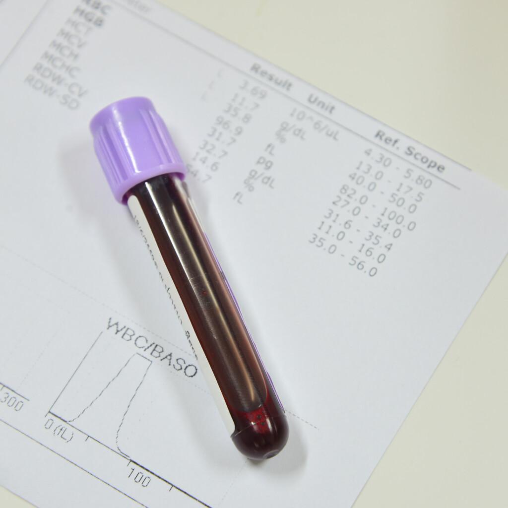 Analisi emocromo Analisi emocromo