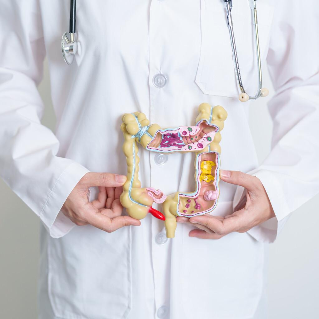 Screening colon retto GRATUITO Screening colon retto GRATUITO