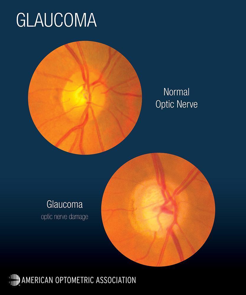Exceptional Eye Care Made Easy: Call To Schedule With Dr. Wilkins or Dr ...