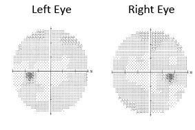 Exceptional Eye Care Made Easy: Call To Schedule With Dr. Wilkins or Dr ...