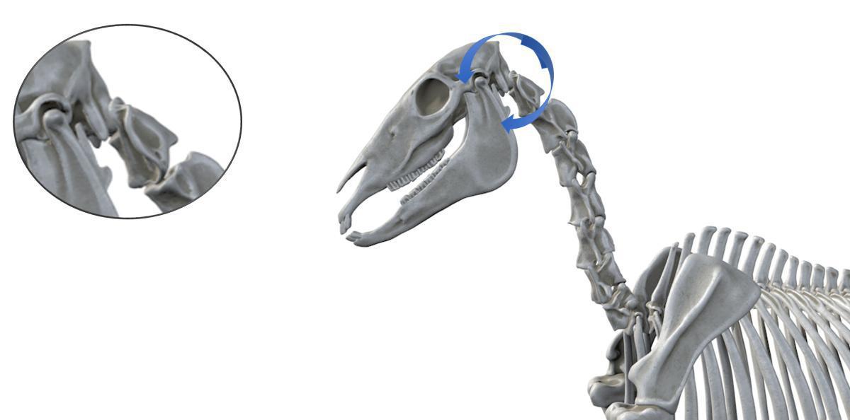 Atlanto-Okzipitalgelenk - Ja-Sager-Gelenk