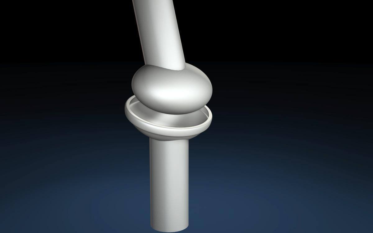 Das Elipsoidengelenk oder auch Eigelenk Das Elipsoidengelenk oder auch Eigelenk