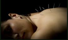 Acupuncture Of Greer