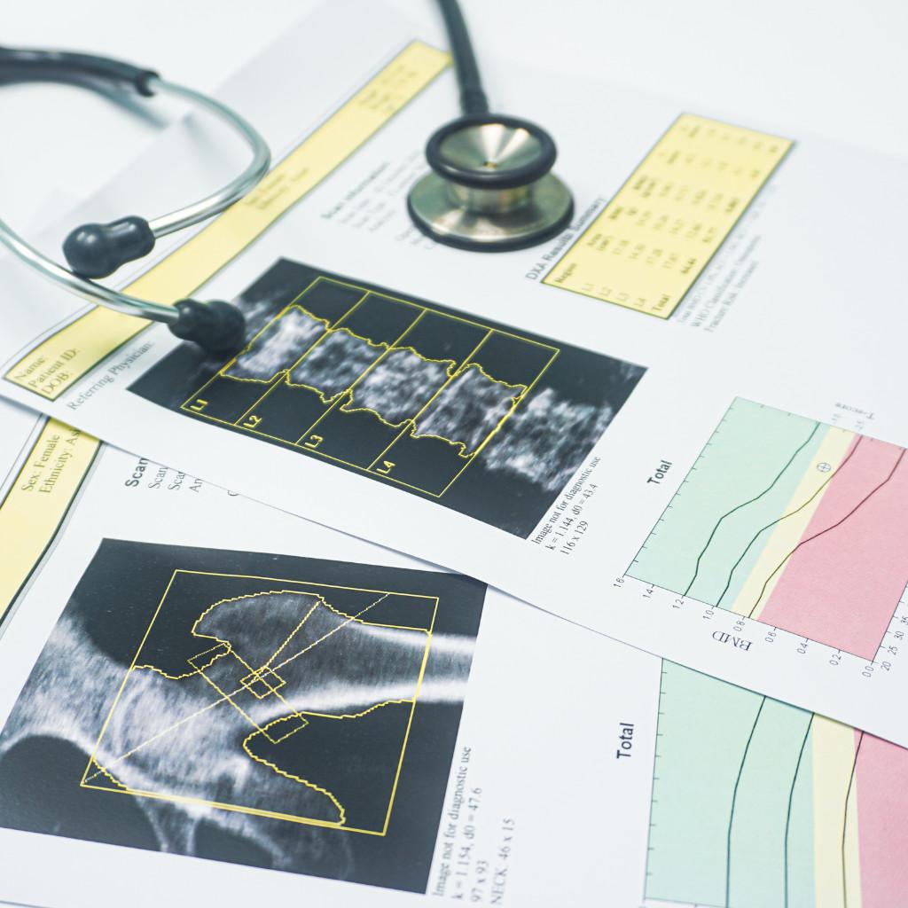 Densitometria ossea ad ultrasuoni