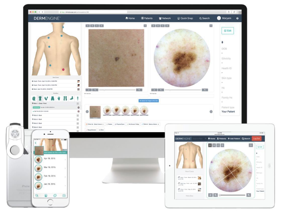 Teledermatologia Teledermatologia