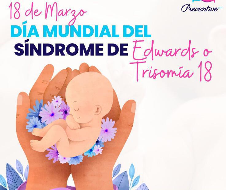 Día Mundial del Síndrome de Edwards: visibilidad, conocimiento y apoyo Día Mundial del Síndrome de Edwards: visibilidad, conocimiento y apoyo