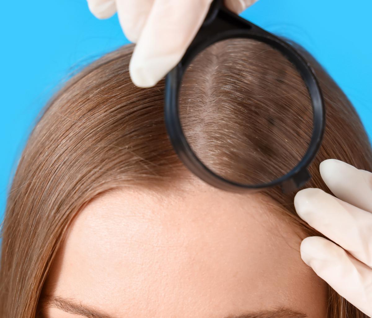 Analisi del cuoio capelluto