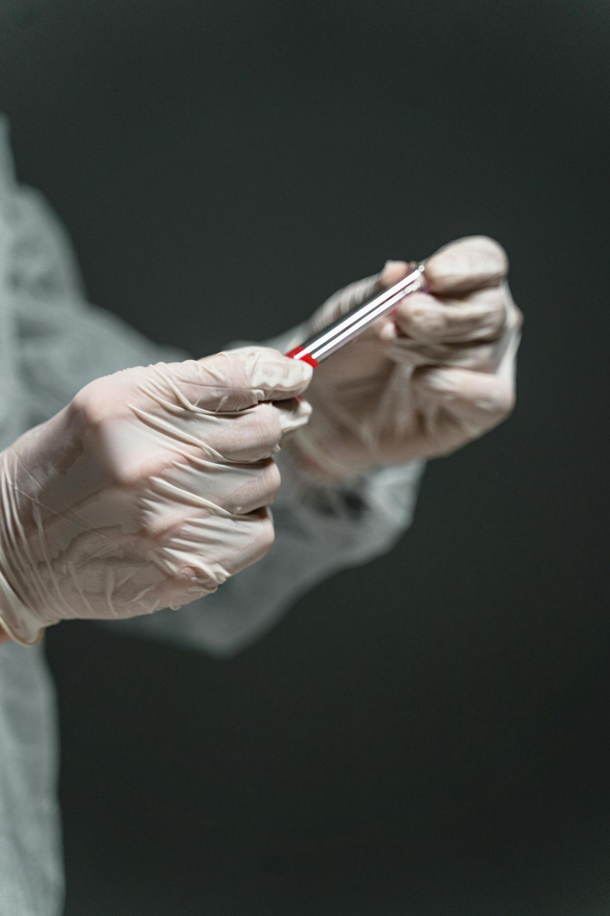 Mpox : face à l'épidémie, l'agence de sécurité sanitaire de Nice passe en alerte Mpox : face à l'épidémie, l'agence de sécurité sanitaire de Nice passe en alerte