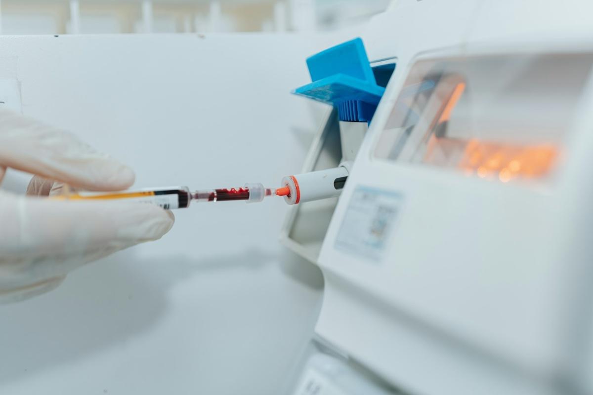 Dépistage du VIH sans rendez-vous ce 1er décembre à Nice