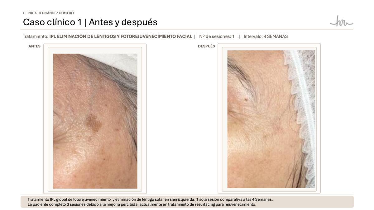 Nuestros casos reales 