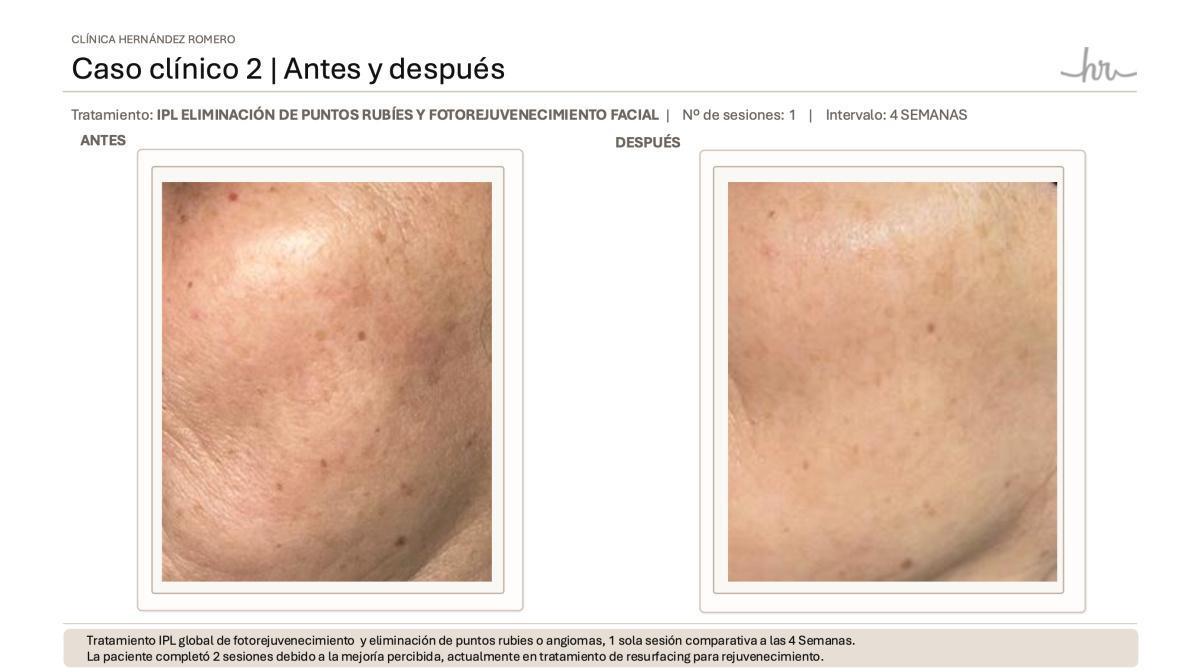 Nuestros casos reales Nuestros casos reales