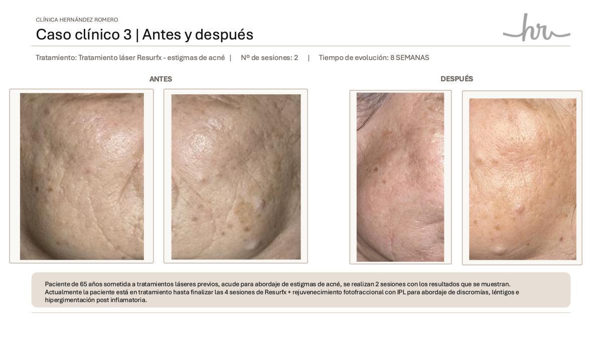 Nuestros casos reales 